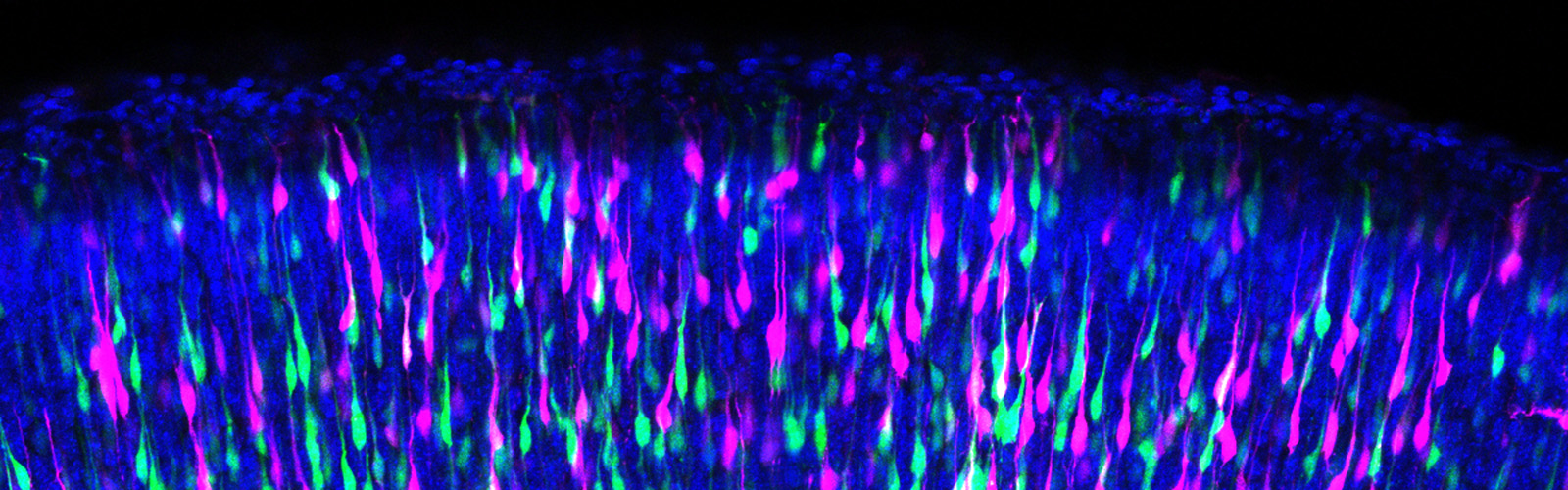 Image of pink and green neurons at the top of the top of a mouse cortex