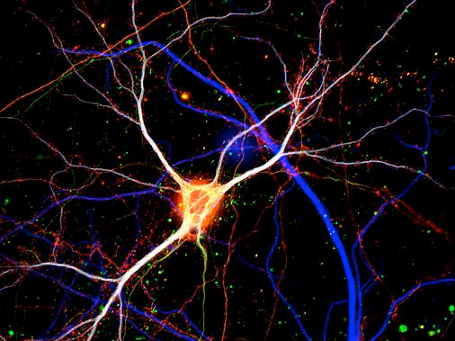 Image of a pyramidal neuron in culture